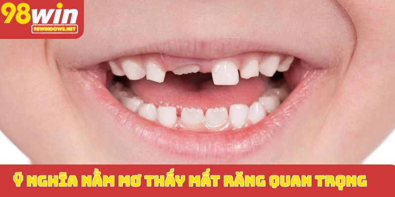 Ý nghĩa nằm mơ thấy mất răng quan trọng